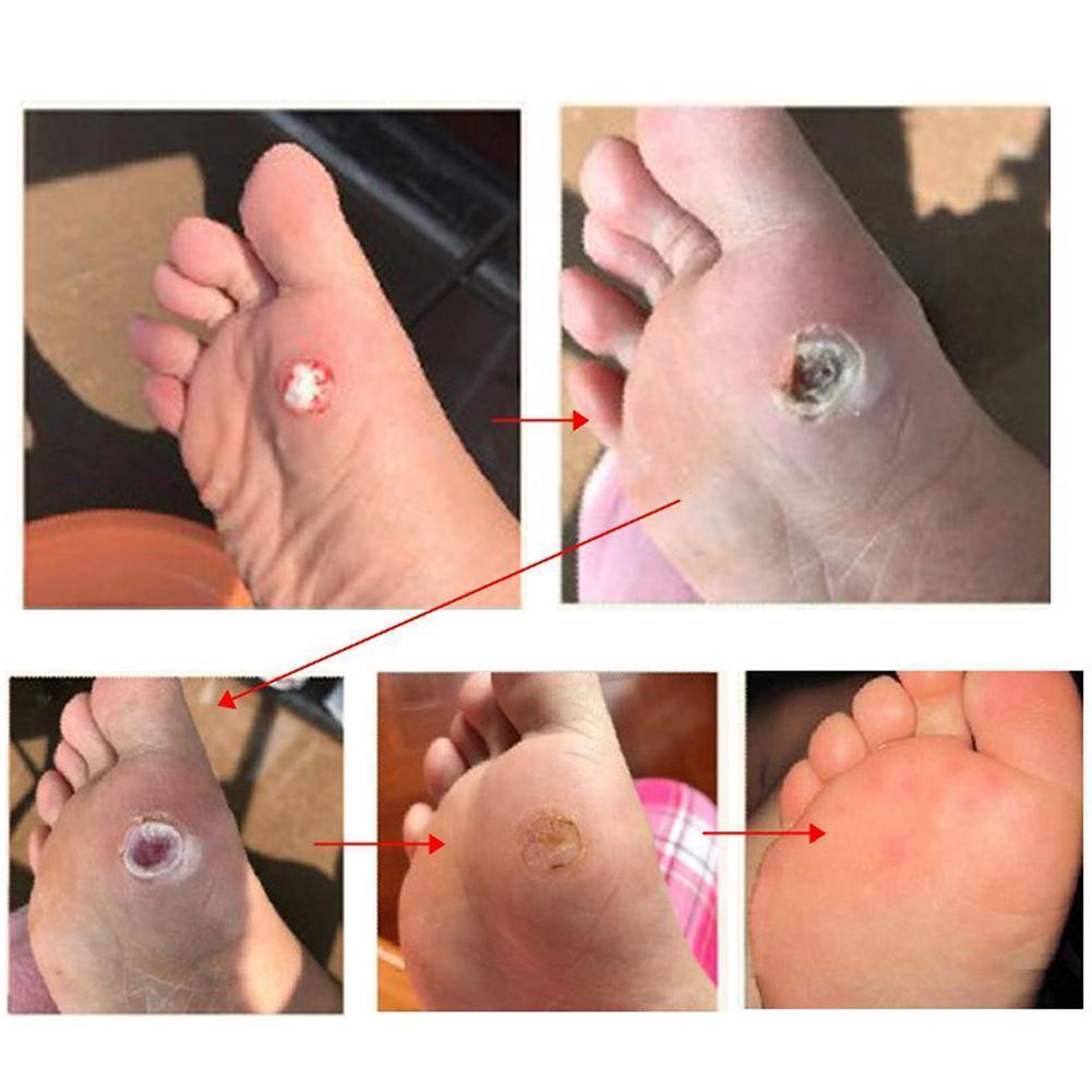 30 Buah/Set Bantalan Pelindung - Heel Liner Grip ulasan dan harga